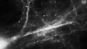 This Is What Memories Look Like -- Mind Blow #78