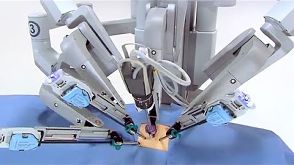 Robot Surgeons are the Future of Medicine